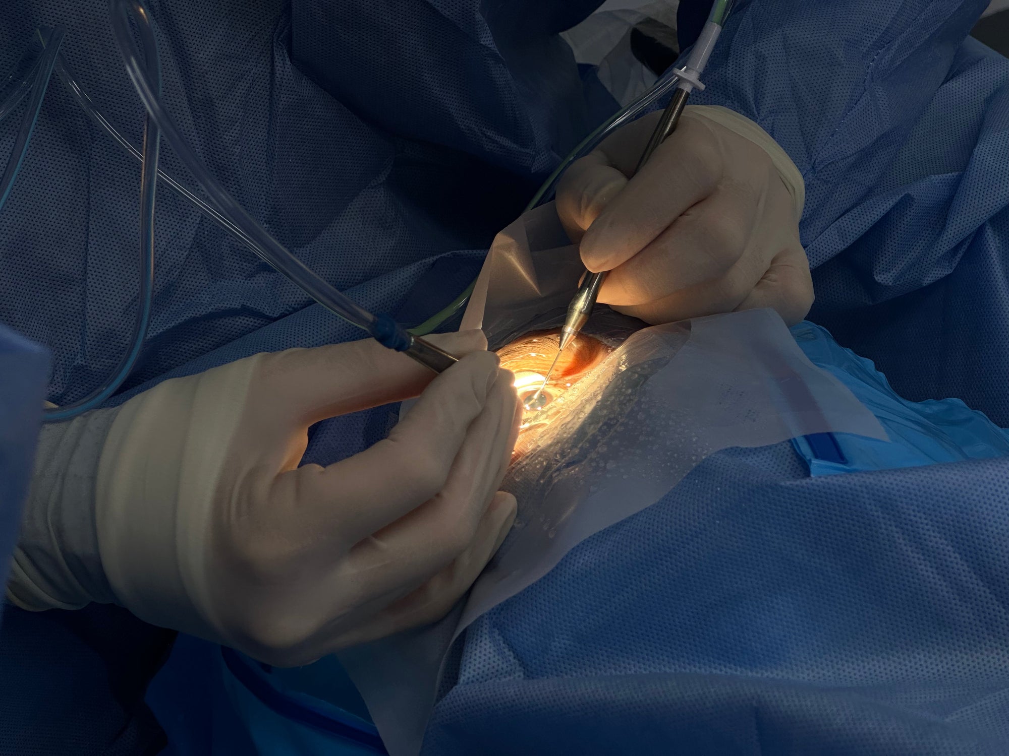 Refractive Lens Exchange in Cartagena: A Definitive Solution for Vision Freedom with Premium Care